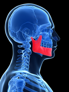Orthognatic Surgery Jaw