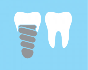 Dental Implant Teeth