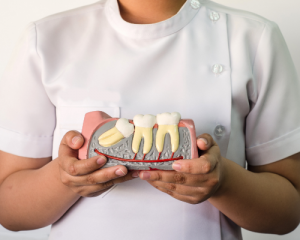 Holding Teeth Diagram