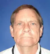 Patient's face after eyelid surgery case 5